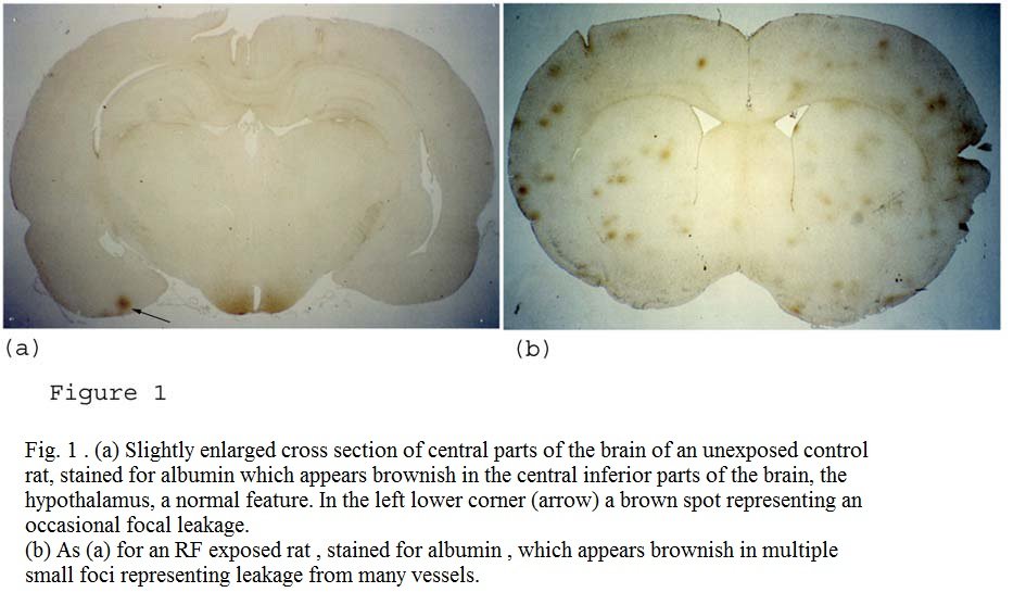 Two stained cross-sections of rat brain tissue side by side: (a) an unexposed control brain showing minimal albumin staining, with one small focal leakage spot noted; (b) an RF-exposed brain showing numerous brownish albumin-stained foci scattered throughout, indicating widespread leakage from many blood vessels